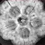5 Mukhi Rudraksha 29.5mm 9.31gm - Xray