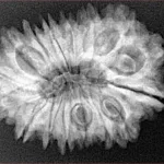 16 Mukhi Rudraksha 29.6mm 5gm - Xray