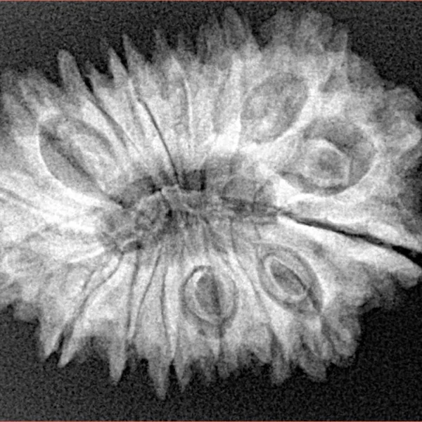 16 Mukhi Rudraksha 29.6mm 5gm - Xray