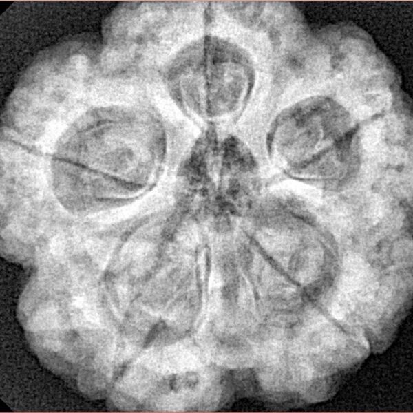 5 Mukhi Rudraksha 29mm 8.83gm - Xray