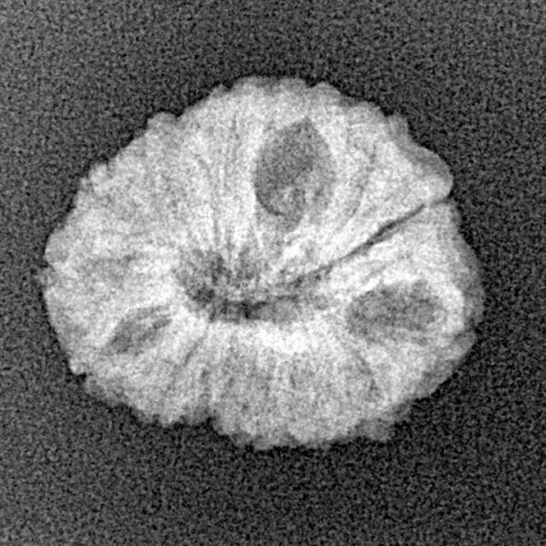 14 Mukhi Rudraksha 19.1mm 1.56gm - Xray