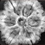 6 Mukhi Rudraksha 30mm 8.07gm - Xray