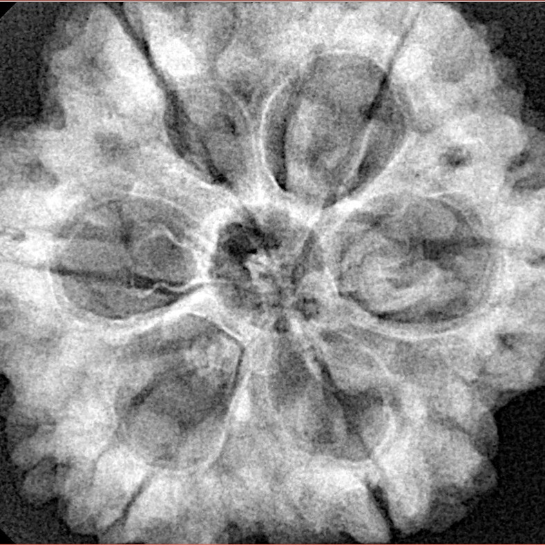 6 Mukhi Rudraksha 30mm 8.07gm - Xray