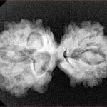 10 Mukhi Mini Trijuti 31.8mm 4.67gm - Xray