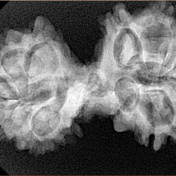 13 Mukhi Mini Trijuti 35mm 5.62gm - Xray