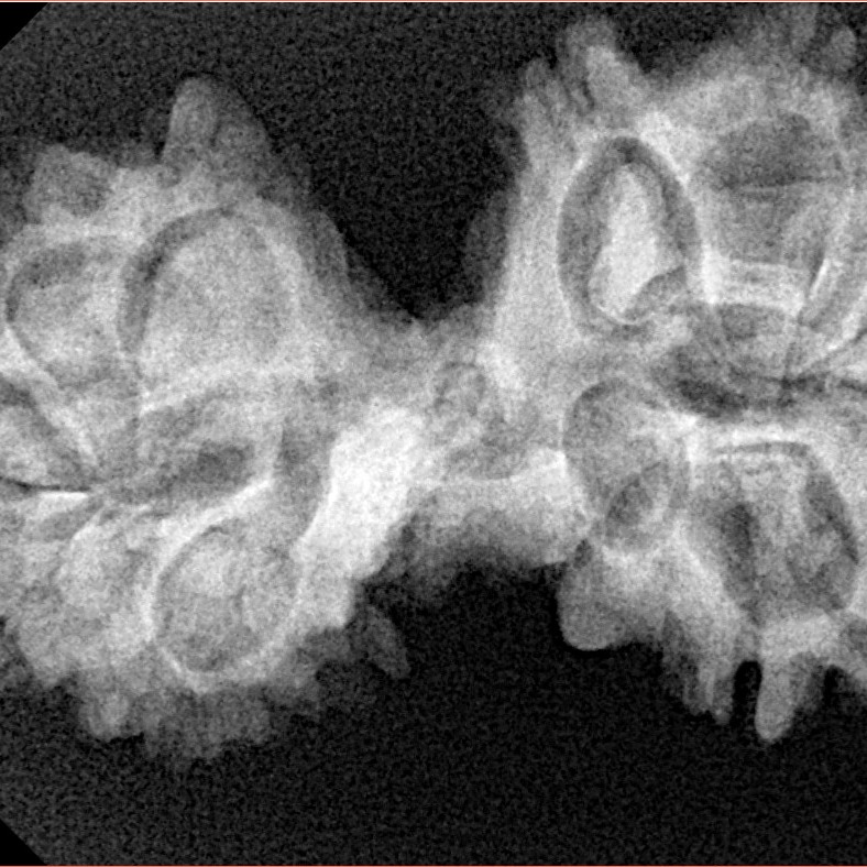 13 Mukhi Mini Trijuti 35mm 5.62gm - Xray