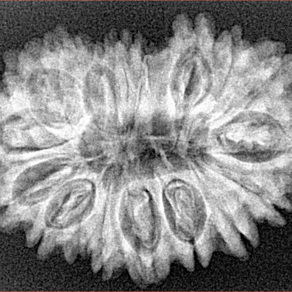 18 Mukhi Rudraksha 30.7mm 4.37gm - Xray