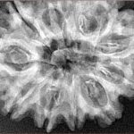 11 Mukhi Rudraksha 32.9mm 6gm - Xray
