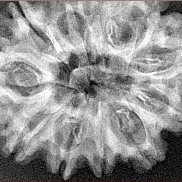 11 Mukhi Rudraksha 32.9mm 6gm - Xray