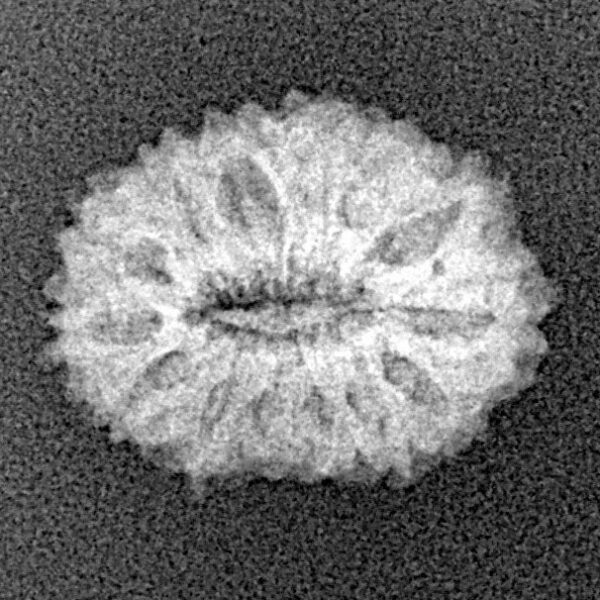14 Mukhi Rudraksha 17mm 1.12gm - Xray