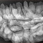 1 Mukhi Rudraksha 39.1mm 6.48gm - Xray