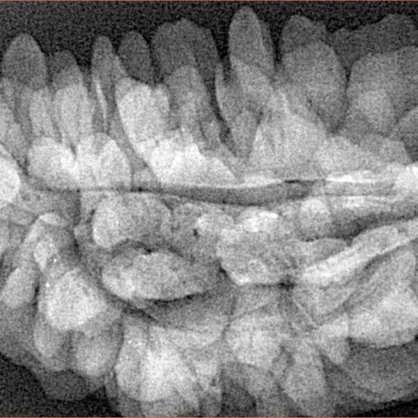 1 Mukhi Rudraksha 39.1mm 6.48gm - Xray