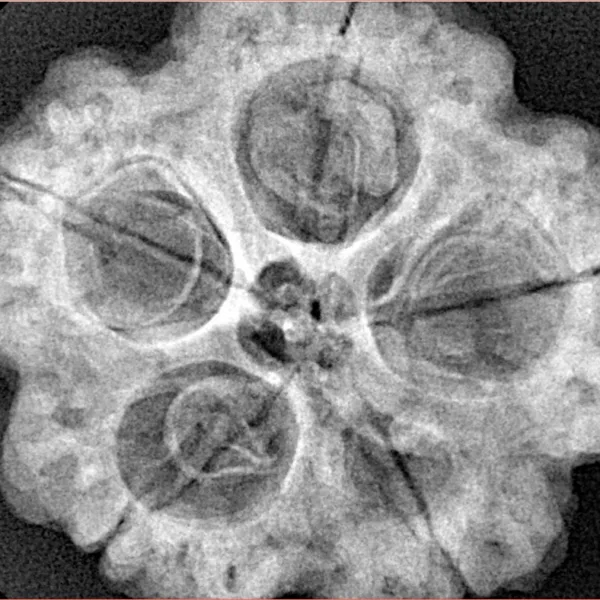 5 Mukhi Rudraksha 29.7mm 8gm - Xray