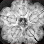 5 Mukhi Rudraksha 30.3mm 9.63gm - Xray