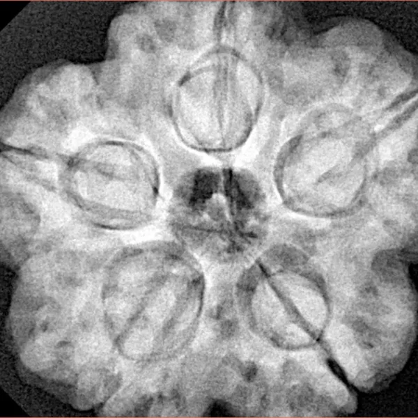 5 Mukhi Rudraksha 30.3mm 9.63gm - Xray