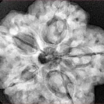 5 Mukhi Rudraksha 30mm 9.43gm - Xray