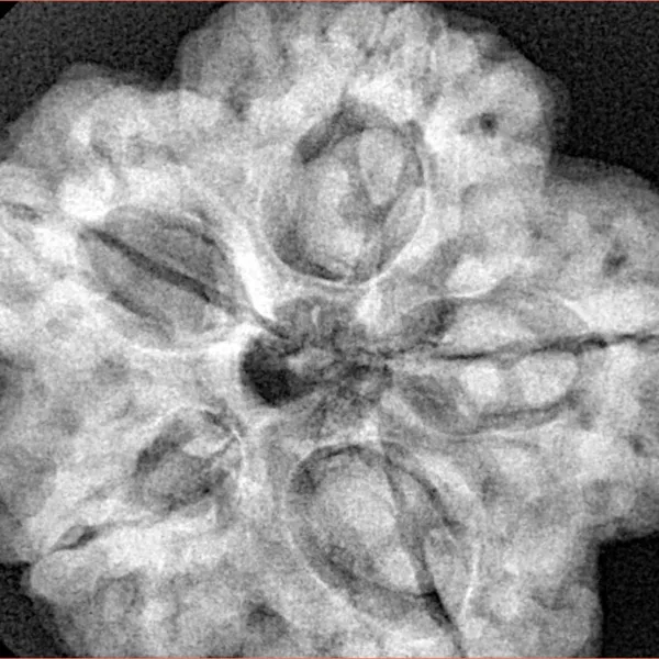 5 Mukhi Rudraksha 30mm 9.43gm - Xray