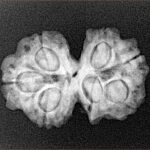 7 MK Gaurishankar 24.7mm 3.12gm - Xray