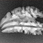 1 + 1 Mukhi Rudraksha 22mm 1.2gm - Xray