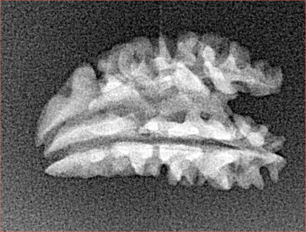 1 + 1 Mukhi Rudraksha 22mm 1.2gm - Xray