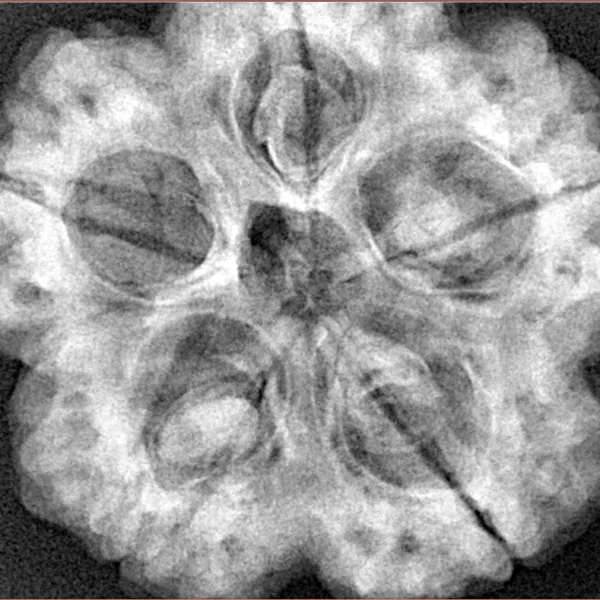 5 Mukhi Rudraksha 30mm 8.89gm - Xray