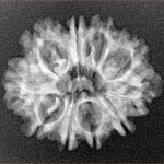 10 Mukhi Rudraksha 24.5mm 2.62gm - Xray