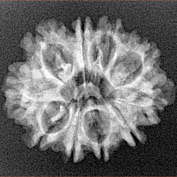 10 Mukhi Rudraksha 24.5mm 2.62gm - Xray
