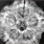 5 Mukhi Rudraksha 29.6mm 8.93gm - Xray