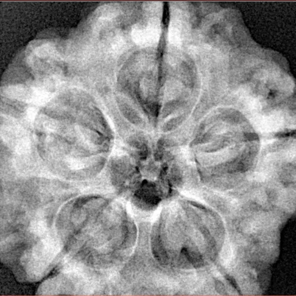 5 Mukhi Rudraksha 29.6mm 8.93gm - Xray