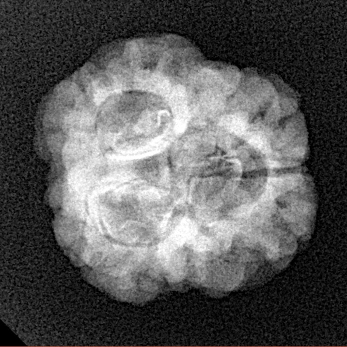 3 Mukhi Rudraksha 25.7mm 3.13gm - Xray