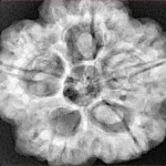 5 Mukhi Rudraksha 29.6mm 8.68gm - Xray