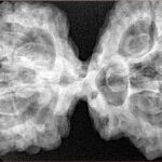 9 Mukhi Mini Trijuti 42.7mm 9.93gm - Xray