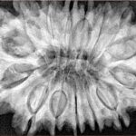 15 Mukhi Rudraksha 34.3mm 8.3gm - Xray