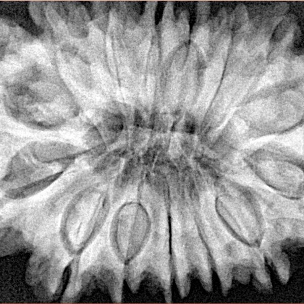 15 Mukhi Rudraksha 34.3mm 8.3gm - Xray