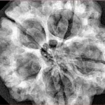 5 Mukhi Rudraksha 30.6mm 7.74gm - Xray