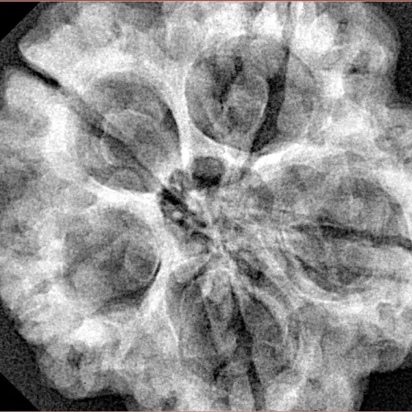 5 Mukhi Rudraksha 30.6mm 7.74gm - Xray