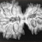 10 Mk Gaurishankar 34.4mm 6.67gm - Xray