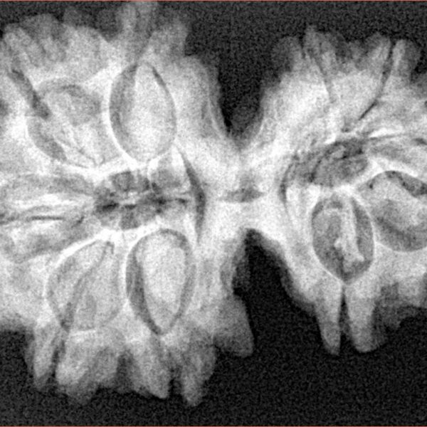 10 Mk Gaurishankar 34.4mm 6.67gm - Xray