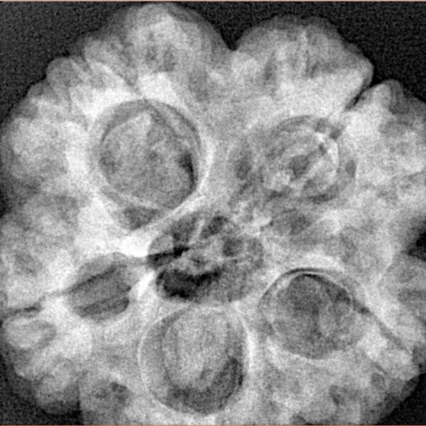 5 Mukhi Rudraksha 29mm 8.16gm - Xray