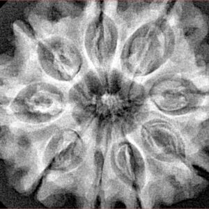 9 Mukhi Rudraksha 32.1mm 6.64gm - Xray
