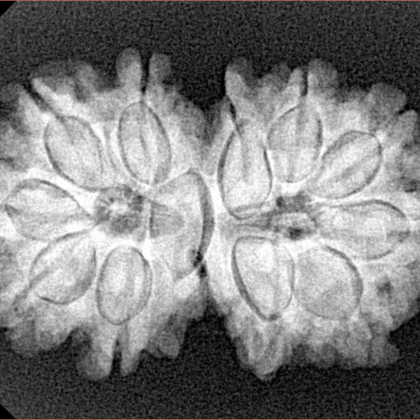 11 MK Gaurishankar 30mm 5gm - Xray