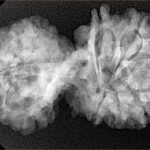 11 Mukhi Mini Trijuti 35mm 5.63gm - Xray