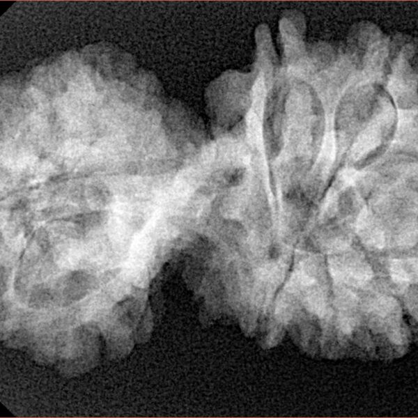 11 Mukhi Mini Trijuti 35mm 5.63gm - Xray