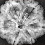 6 Mukhi Rudraksha 29.3mm 8.12gm - Xray