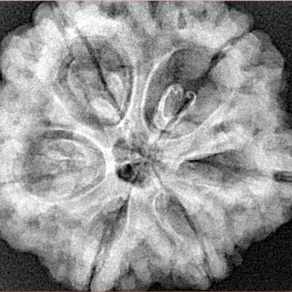 6 Mukhi Rudraksha 29.3mm 8.12gm - Xray