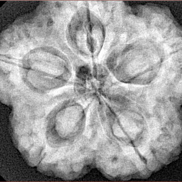 5 Mukhi Rudraksha 29.5mm 8.63gm - Xray