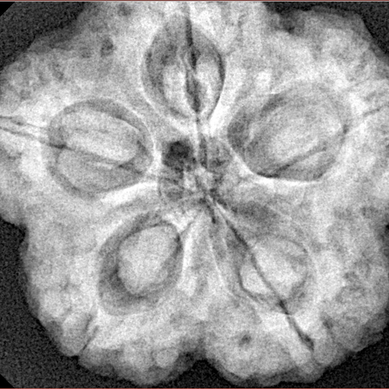 5 Mukhi Rudraksha 29.5mm 8.63gm - Xray