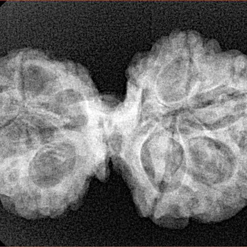 11 Mukhi Mini Trijuti 32.3mm 4.89gm - Xray