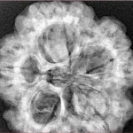 5 Mukhi Rudraksha 29.7mm 8.77gm - Xray