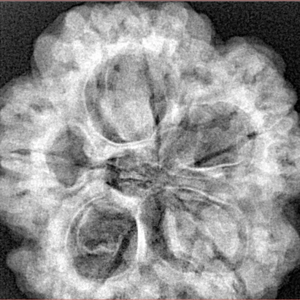 5 Mukhi Rudraksha 29.7mm 8.77gm - Xray